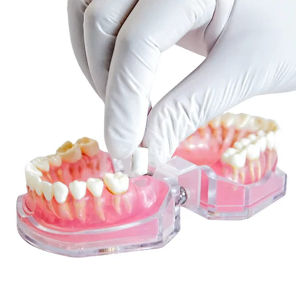 AlloFiber™ 100 % Allograft Bone Plug - Image 3