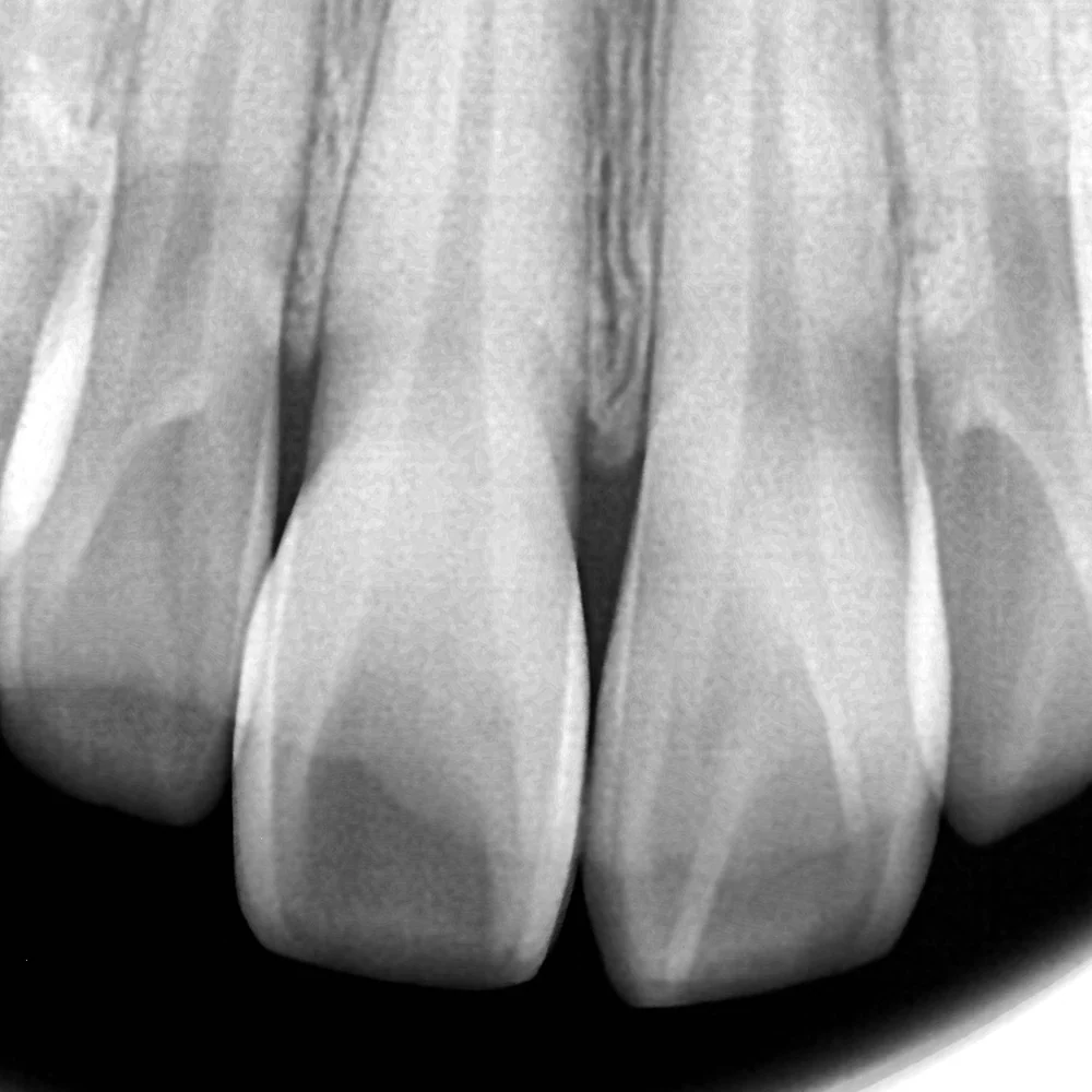 Digital Intraoral Image Sensor - CALL FOR PRICE - Image 3