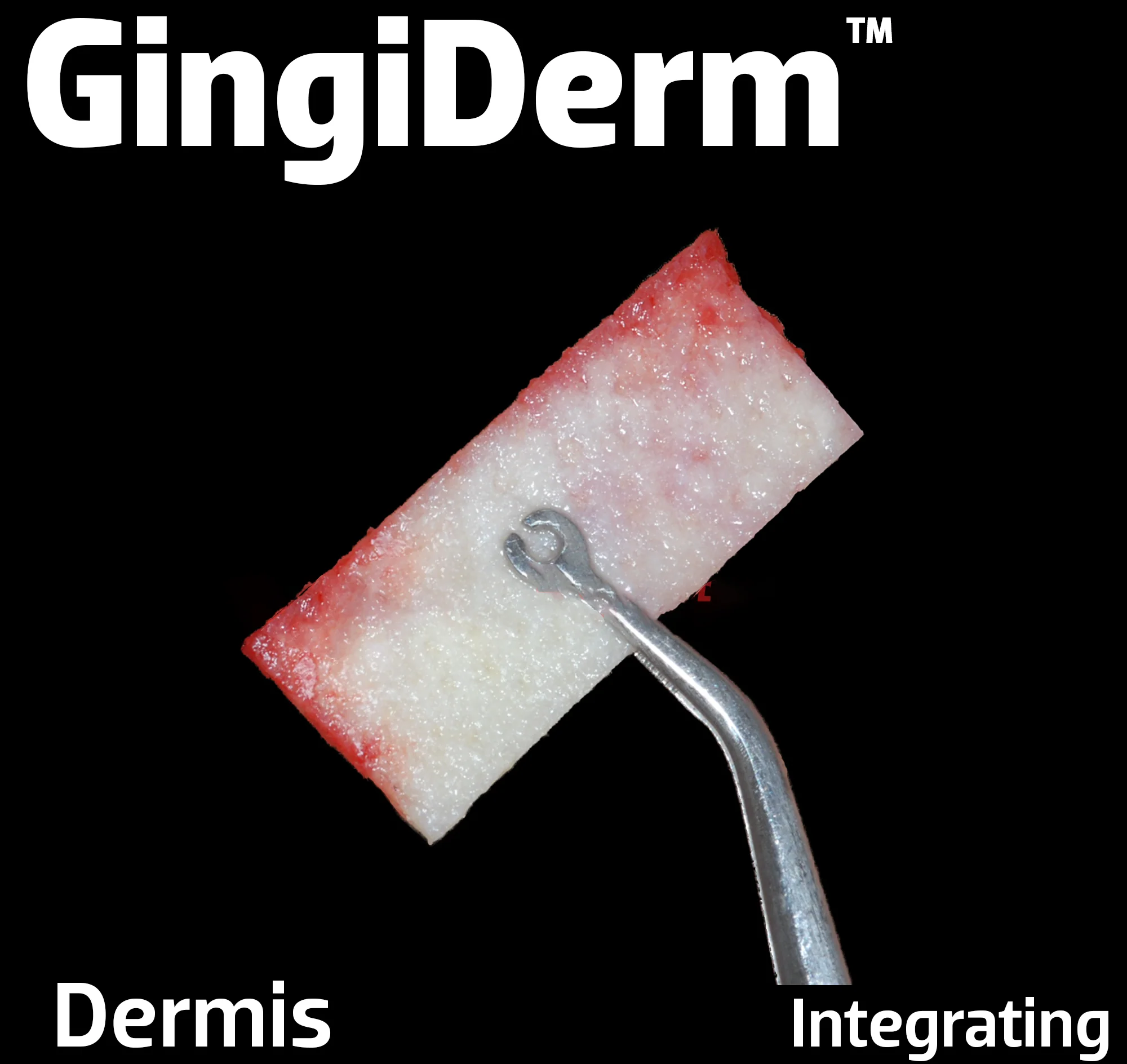 GingiDerm Acellular Dermis - Image 3